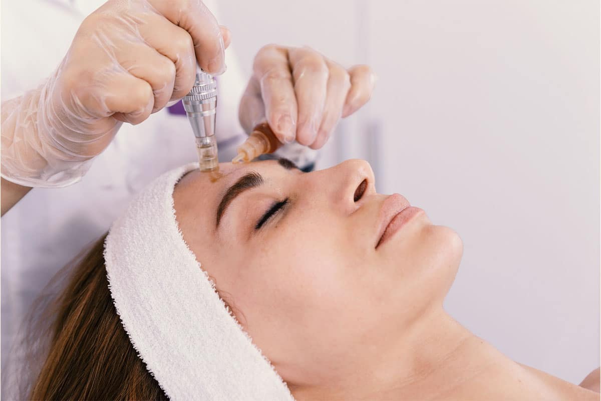Morpheus8 Body By LA Ageless Medical | Beverly Hills, CA