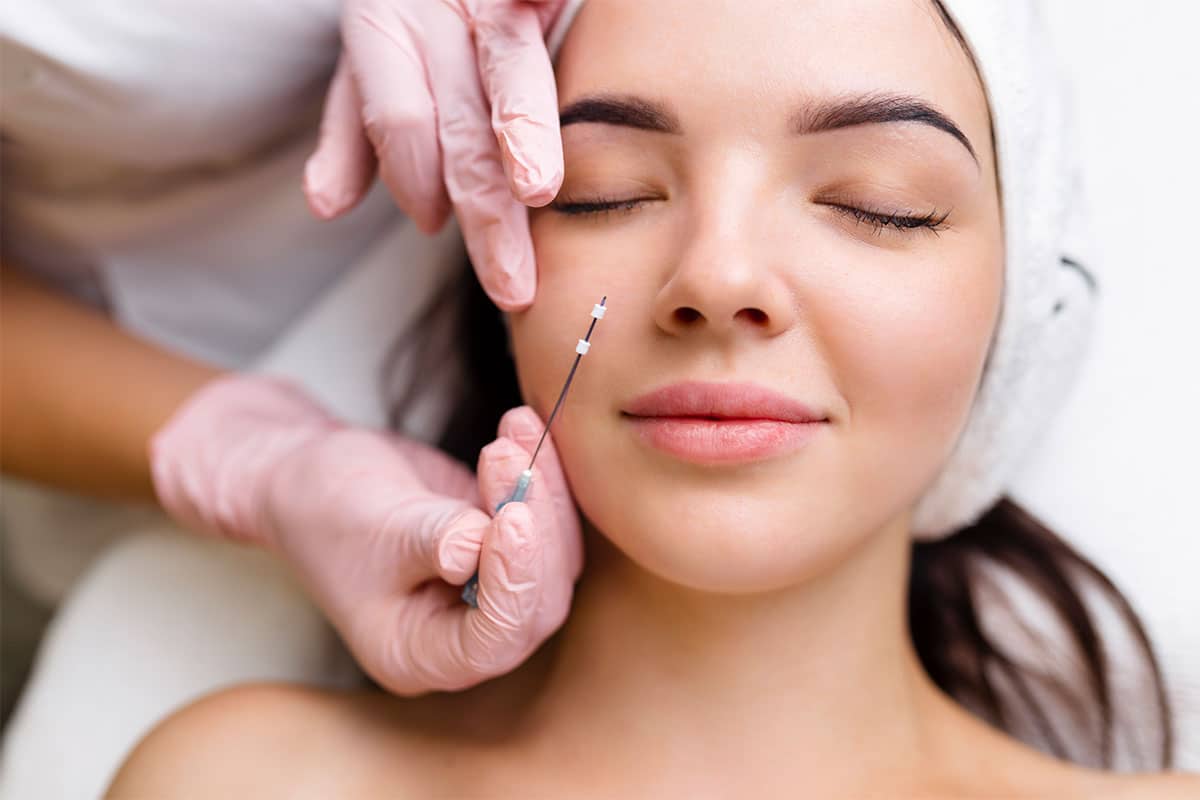 PDO Thread Lift By LA Ageless Medical | Beverly Hills, CA