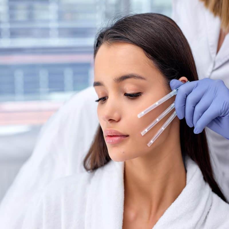 PDO Thread Lift Services by LA Ageless Medical Aesthetics in Beverly Hills CA