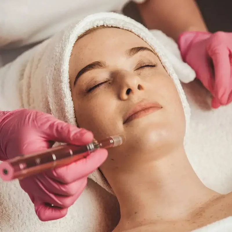 Micro-needling by LA Ageless Medical Aesthetics in Beverly Hills CA