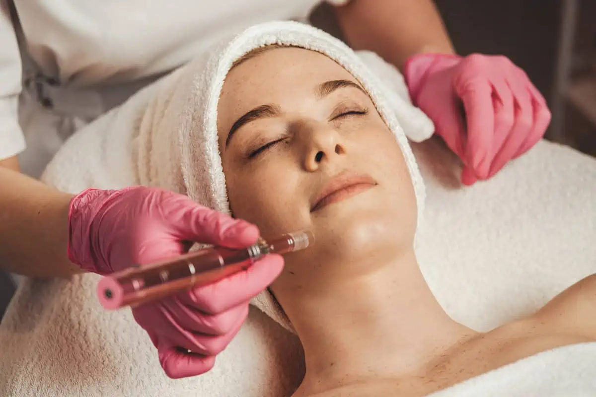 Micro-needling by LA Ageless Medical Aesthetics in Beverly Hills CA