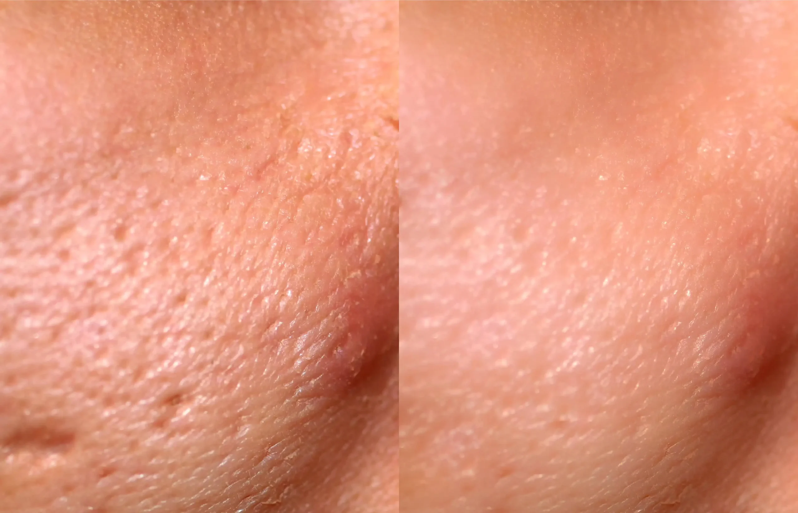PRP/PRF Treatment by LA Ageless Medical | Medical Spa in Beverly Hills, CA