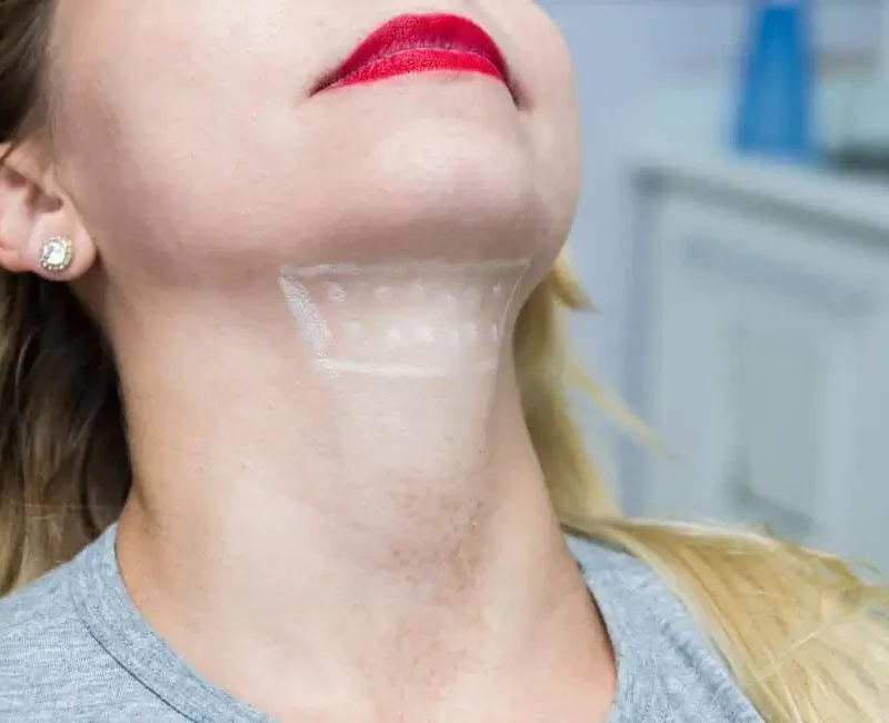 Kybella by LA Ageless Medical Aesthetic in Beverly Hills, CA