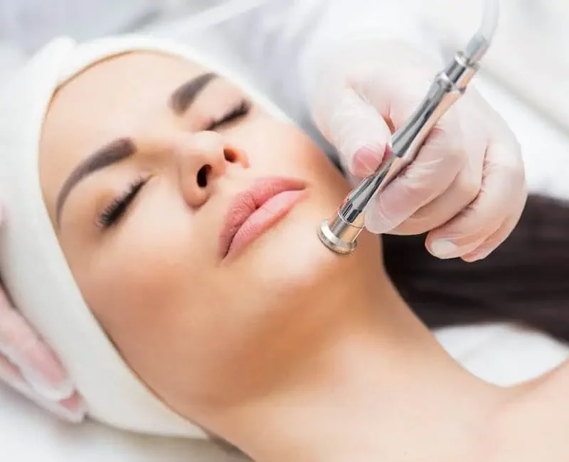 Microneedling by LA Ageless Medical Aesthetics in Beverly Hills, CA