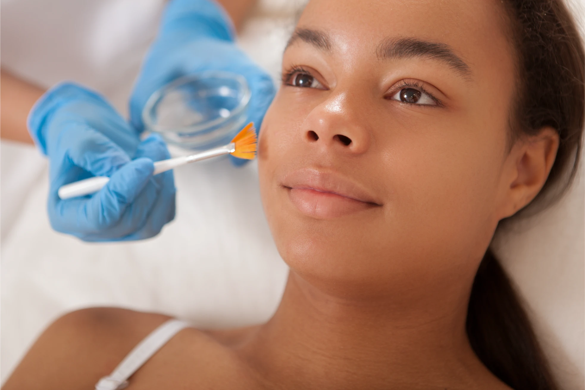 Chemical Peels in Beverly Hills, CA