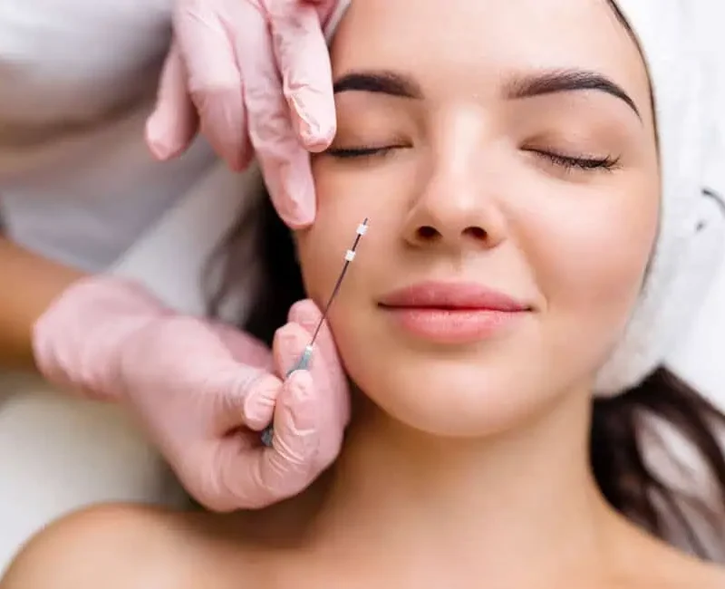 PDO Smooth Threads Lift by LA Ageless Medical Aesthetics
