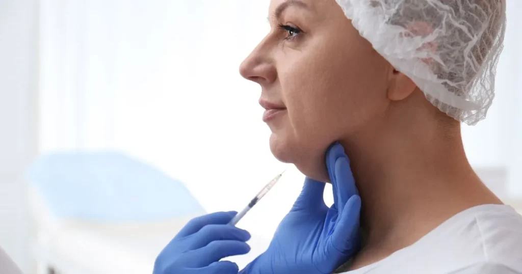 Kybella injection for double chin fat reduction in Beverly Hills, CA