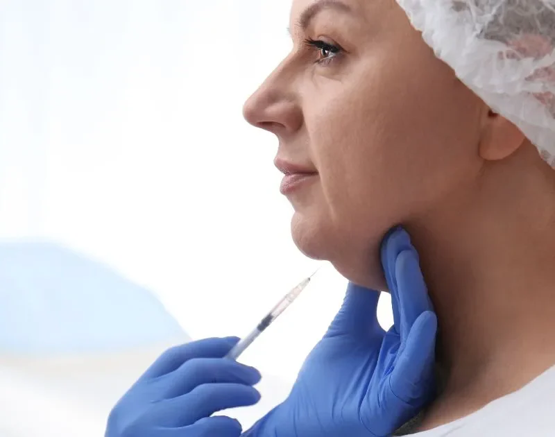Kybella injection for double chin fat reduction in Beverly Hills, CA